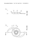 MASKED INTRAOCULAR IMPLANTS AND LENSES diagram and image