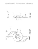 MASKED INTRAOCULAR IMPLANTS AND LENSES diagram and image