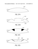 MASKED INTRAOCULAR IMPLANTS AND LENSES diagram and image