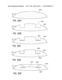 MASKED INTRAOCULAR IMPLANTS AND LENSES diagram and image