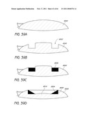 MASKED INTRAOCULAR IMPLANTS AND LENSES diagram and image