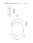 INTRAOCULAR LENS SYSTEM diagram and image