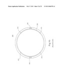 INTRAOCULAR LENS SYSTEM diagram and image