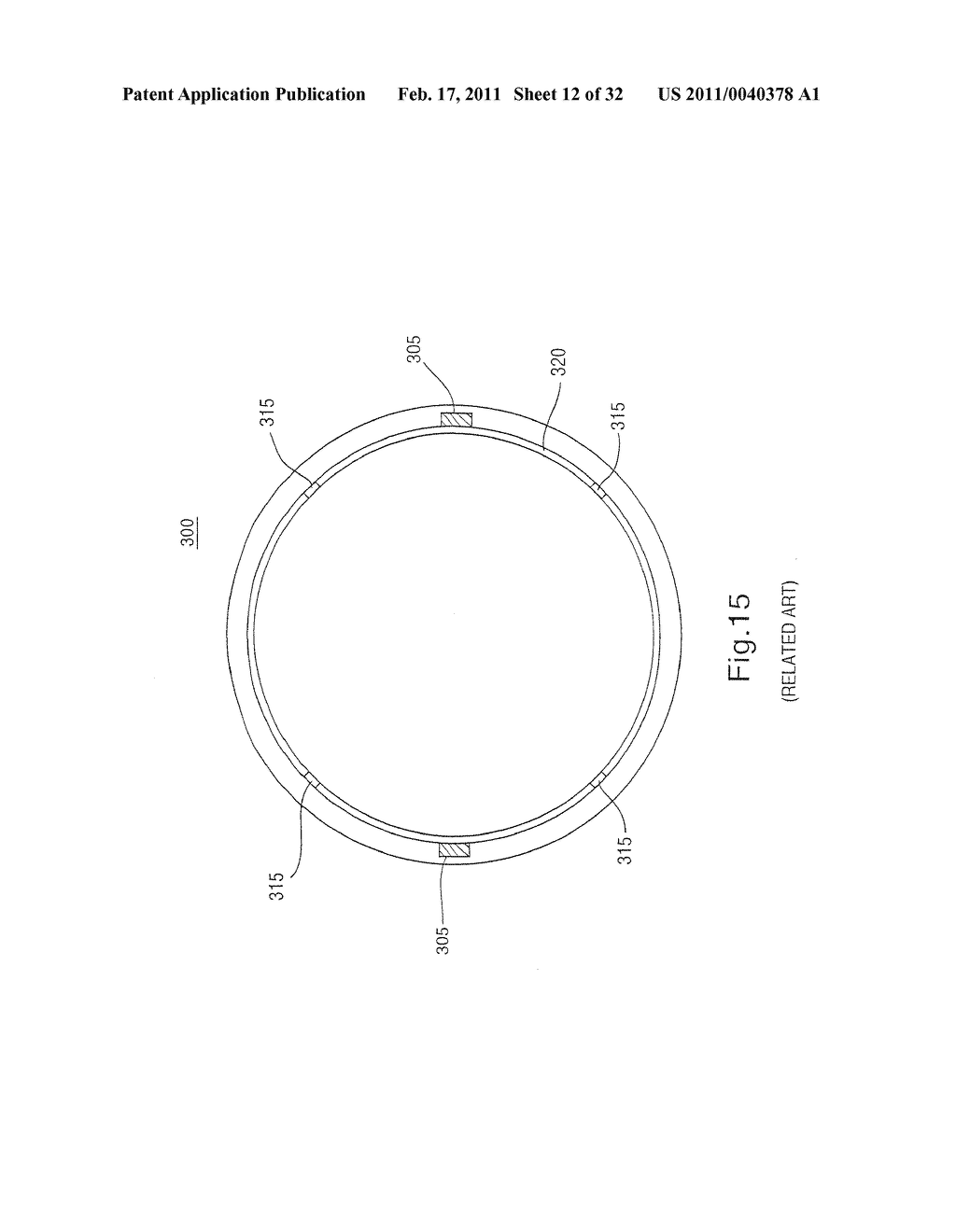 INTRAOCULAR LENS SYSTEM - diagram, schematic, and image 13