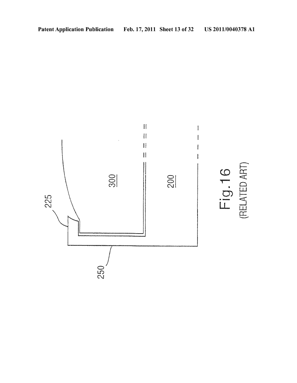 INTRAOCULAR LENS SYSTEM - diagram, schematic, and image 14