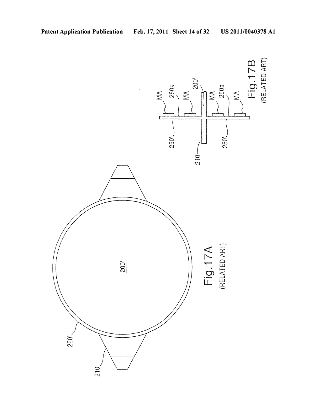 INTRAOCULAR LENS SYSTEM - diagram, schematic, and image 15