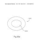 INTRAOCULAR LENS SYSTEM diagram and image