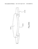 INTRAOCULAR LENS SYSTEM diagram and image