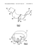 EXHAUST GAS RECIRCULATION DEVICE FOR AN INTERNAL COMBUSTION ENGINE diagram and image