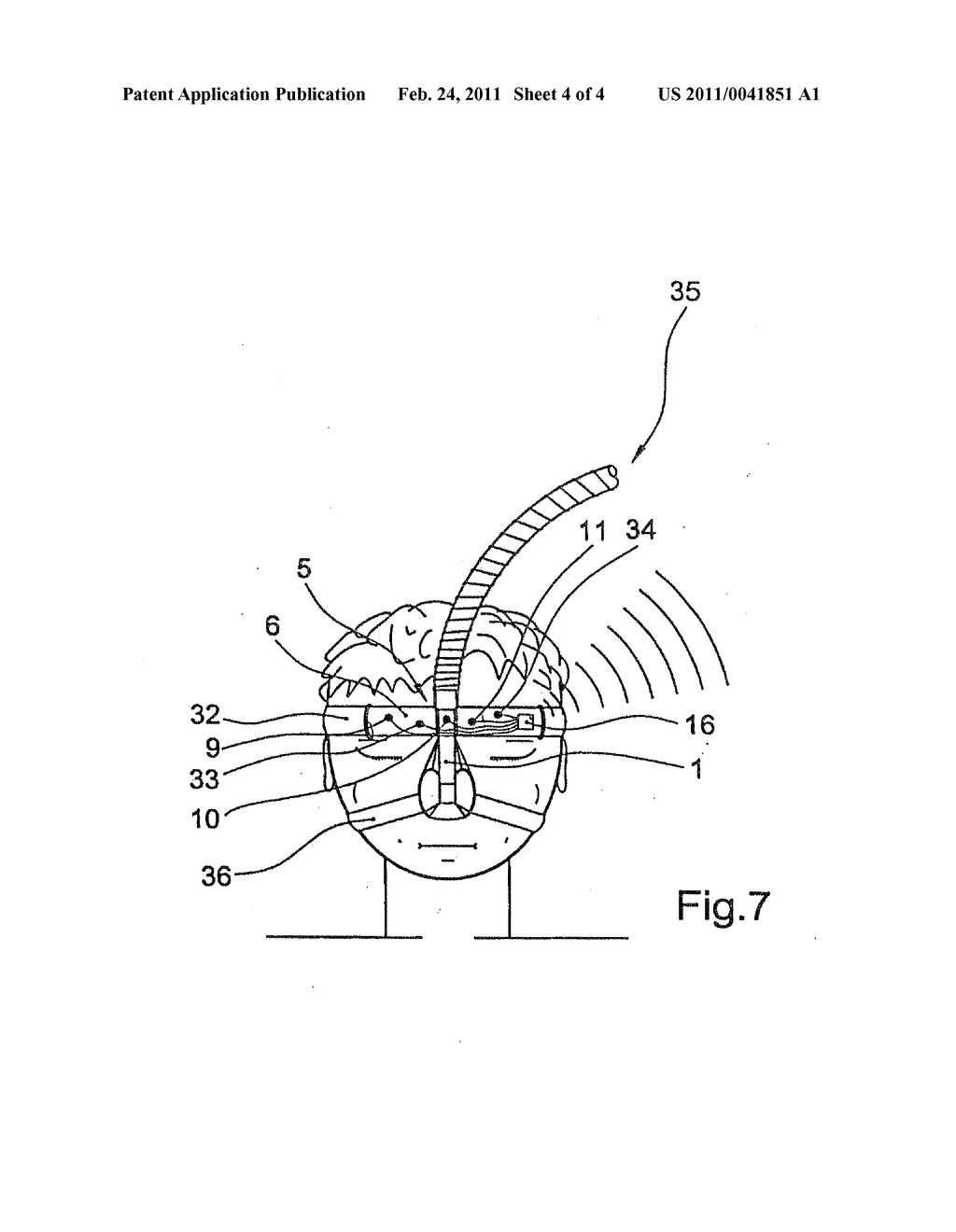 DEVICE FOR DETECTING ELECTRICAL POTENTIALS OF THE FOREHEAD REGION OF A PATIENT - diagram, schematic, and image 05