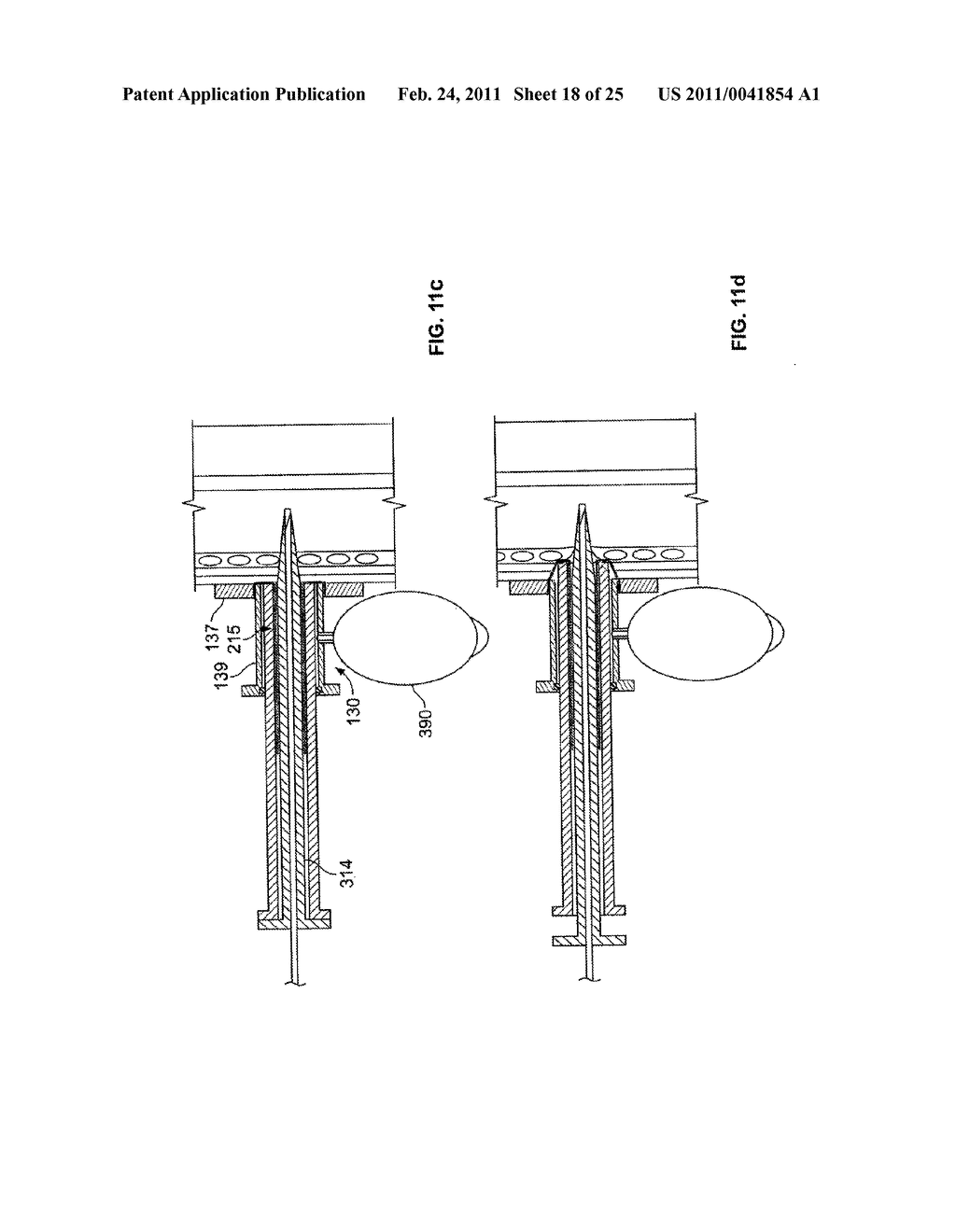 EVERTING DEVICE AND METHOD FOR TRACHEOSTOMY - diagram, schematic, and image 19