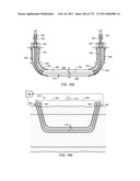 IRREGULAR PATTERN TREATMENT OF A SUBSURFACE FORMATION diagram and image