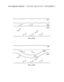 IRREGULAR PATTERN TREATMENT OF A SUBSURFACE FORMATION diagram and image