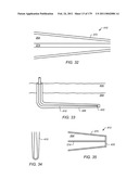 IRREGULAR PATTERN TREATMENT OF A SUBSURFACE FORMATION diagram and image