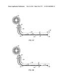 IRREGULAR PATTERN TREATMENT OF A SUBSURFACE FORMATION diagram and image