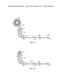 IRREGULAR PATTERN TREATMENT OF A SUBSURFACE FORMATION diagram and image