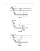 IRREGULAR PATTERN TREATMENT OF A SUBSURFACE FORMATION diagram and image