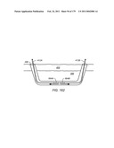 IRREGULAR PATTERN TREATMENT OF A SUBSURFACE FORMATION diagram and image