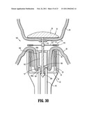 Annular Adhesive Structure diagram and image