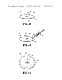 Annular Adhesive Structure diagram and image