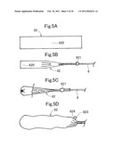 CABLE-INSERTING APPARATUS diagram and image