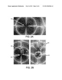 WIRELESS ENERGY TRANSFER WITH HIGH-Q CAPACITIVELY LOADED CONDUCTING LOOPS diagram and image