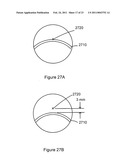 Multifocal Lens Having A Progressive Optical Power Region and a Discontinuity diagram and image