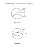 Multifocal Lens Having A Progressive Optical Power Region and a Discontinuity diagram and image