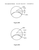 Multifocal Lens Having A Progressive Optical Power Region and a Discontinuity diagram and image