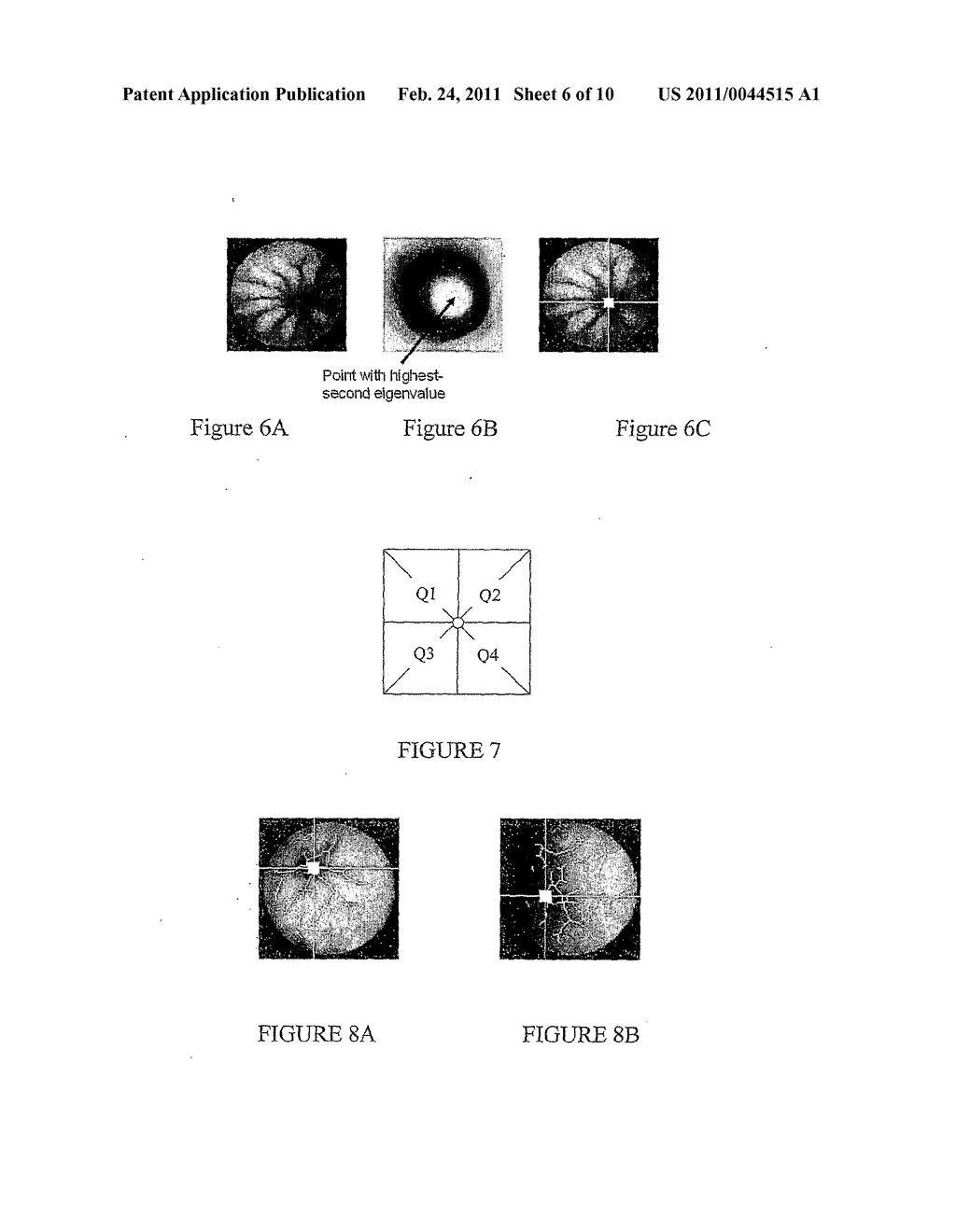 DEVICE, SYSTEM AND METHOD FOR AUTOMATIC DETECTION OF CONTRACTILE ACTIVITY IN AN IMAGE FRAME - diagram, schematic, and image 07