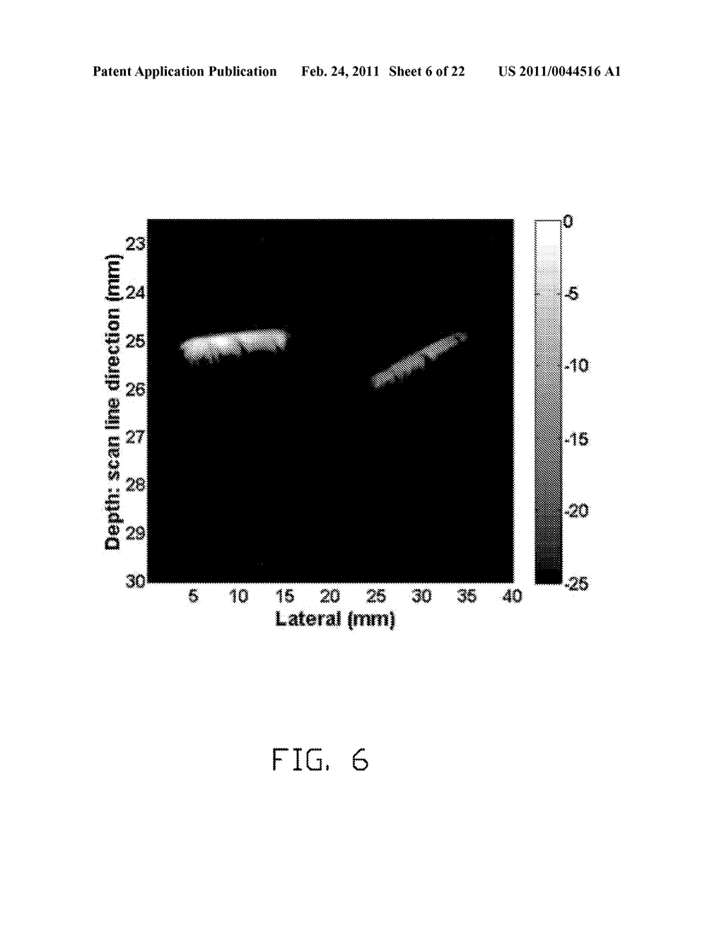 CONTRAST IMPROVEMENT METHOD AND SYSTEM FOR PHOTOACOUSTIC IMAGING - diagram, schematic, and image 07