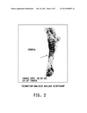 METHOD OF IMAGING LOCALIZED INFECTIONS diagram and image