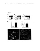 Methods and Compositions for Treating and Identifying Compounds to Treat Age-Related Macular Degeneration diagram and image