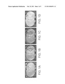 Use of Functionalized Magnetic Nanoparticles in Cancer Detection and Treatment diagram and image