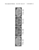 Use of Functionalized Magnetic Nanoparticles in Cancer Detection and Treatment diagram and image