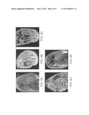 Use of Functionalized Magnetic Nanoparticles in Cancer Detection and Treatment diagram and image