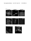 Generation of Induced Pluripotent Stem Cells from Cord Blood diagram and image