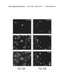 PORCINE TORQUE TENO VIRUS VACCINES AND DIAGNOSIS diagram and image