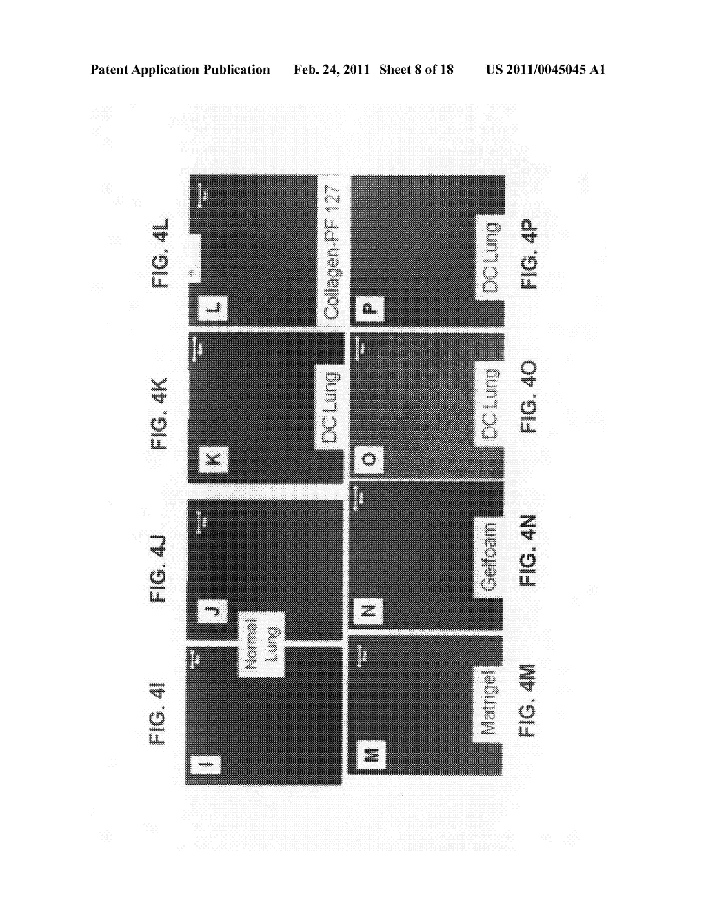 Production of and uses for decellularized lung tissue - diagram, schematic, and image 09