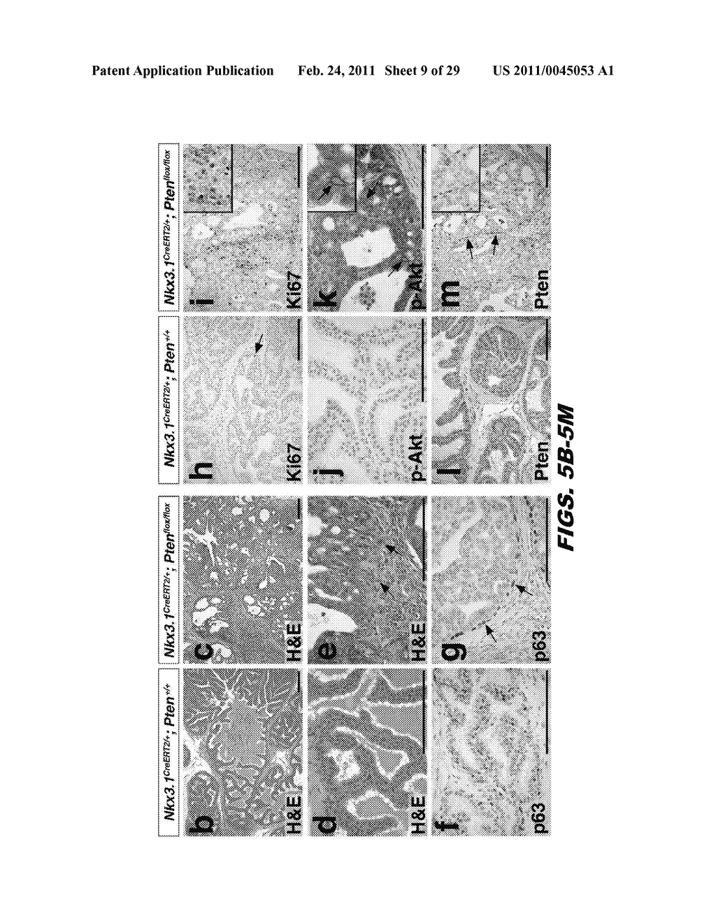 ISOLATED POPULATION OF LUMINAL STEM CELLS THAT GIVE RISE TO PROSTATE CANCER AND METHODS OF USING SAME - diagram, schematic, and image 10