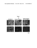 KIT FOR DETECTING CANCER CELLS METASTASIZING INTO SENTINEL LYMPH NODE diagram and image