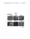 KIT FOR DETECTING CANCER CELLS METASTASIZING INTO SENTINEL LYMPH NODE diagram and image