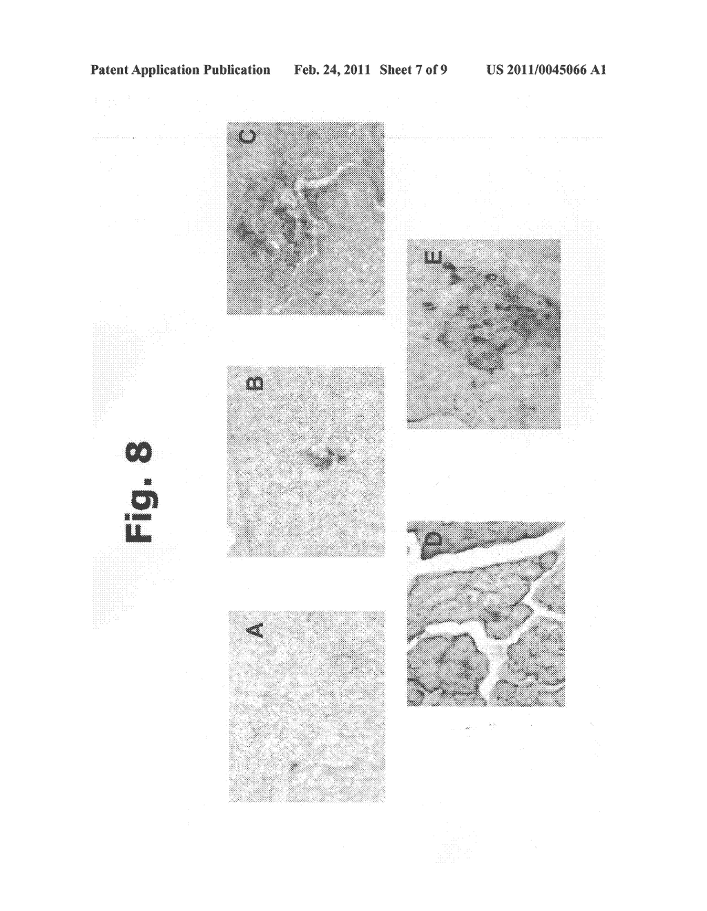 Pharmaceutical compound containing silymarin and carbopol, its manufacturing process and its use as a regenerator of the pancreatic tissue and cells of endogenous secretion damaged by diabetes mellitus - diagram, schematic, and image 08