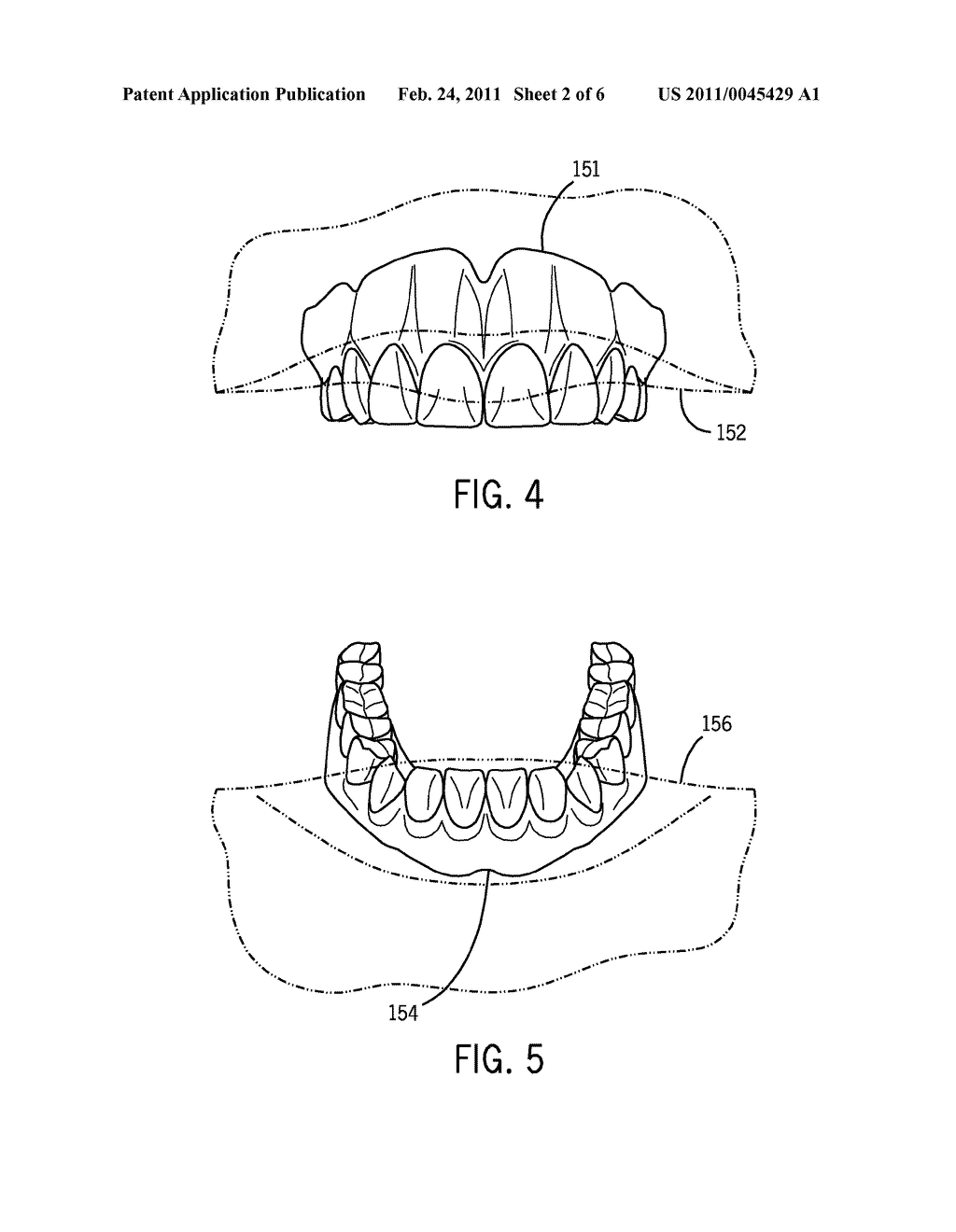 Dental Prosthesis Removal Tool - diagram, schematic, and image 03