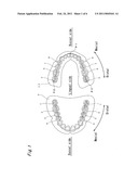 ARTIFICIAL MOLAR TEETH diagram and image