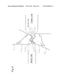 ARTIFICIAL MOLAR TEETH diagram and image