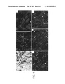 UPREGULATION OF RACK-1 IN MELANOMA AND ITS USE AS A MARKER diagram and image