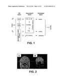 TREATMENT OF IMPULSE CONTROL DISORDERS diagram and image