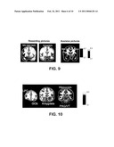 TREATMENT OF IMPULSE CONTROL DISORDERS diagram and image