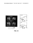 TREATMENT OF IMPULSE CONTROL DISORDERS diagram and image